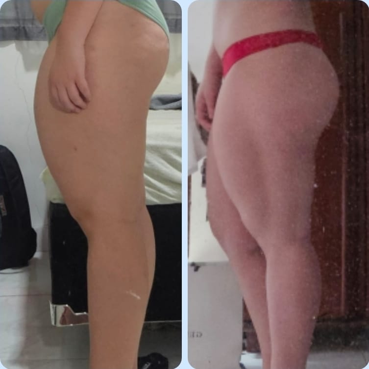 Comparativo da evolução obtida em quatro meses